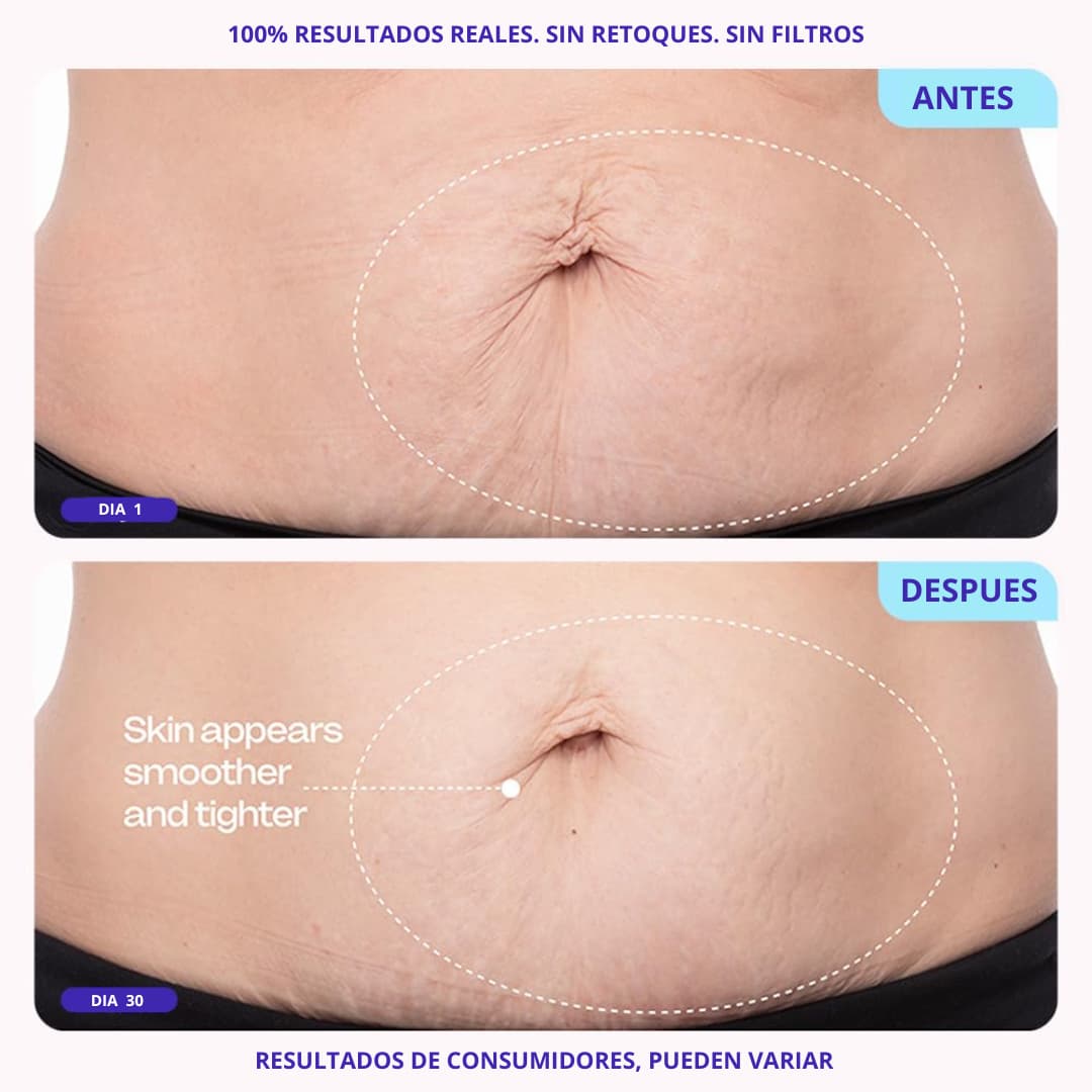 Crema Reafirmante de Vientre