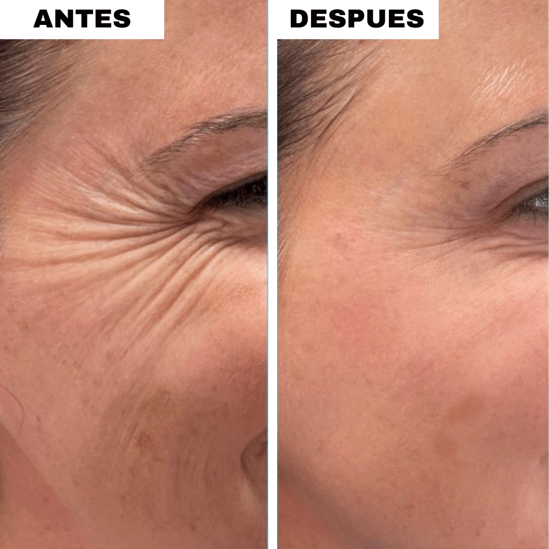 Crema Instantánea Reafirmante de Ojos (2x1)