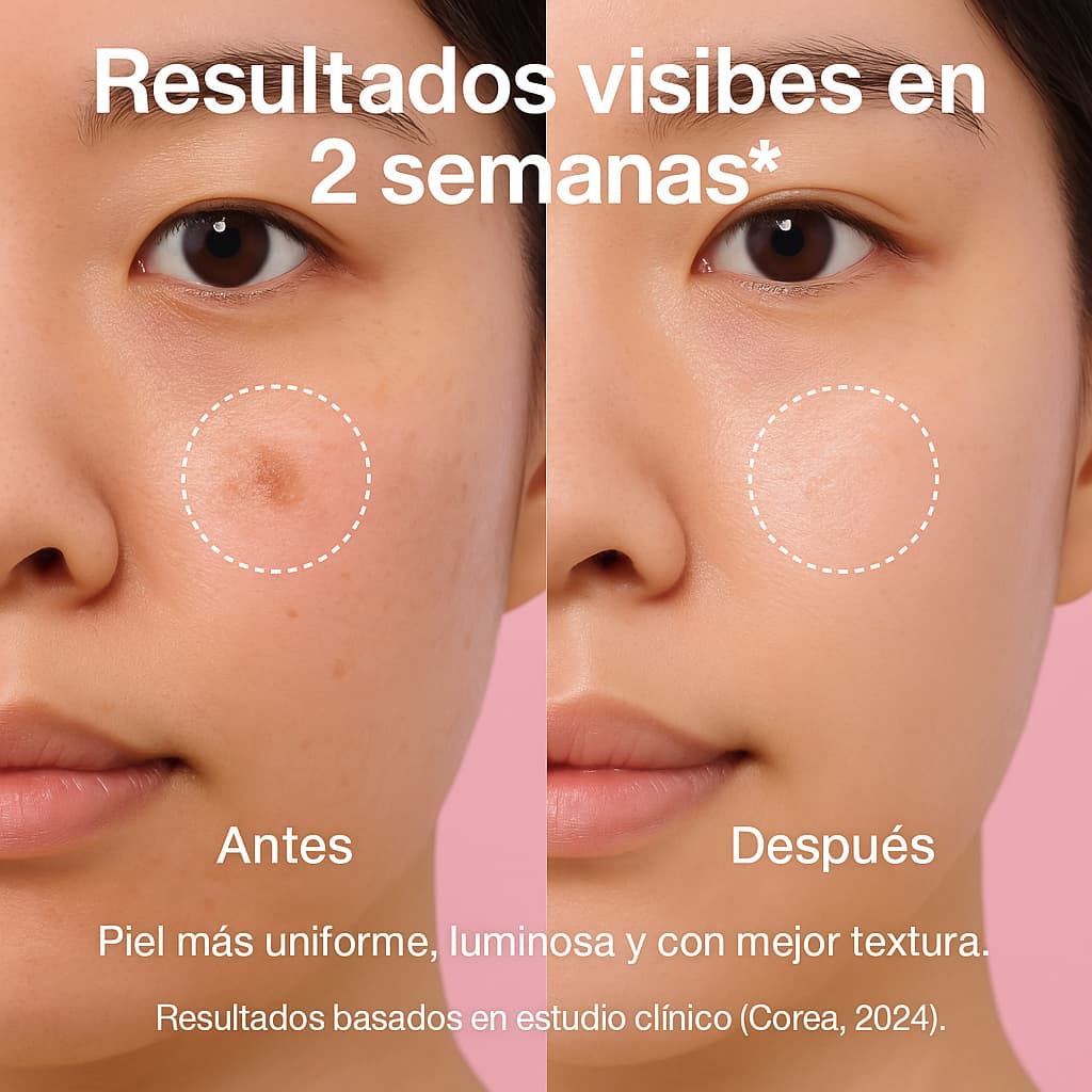 Serum de Niacinamida Antimanchas