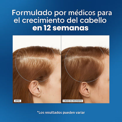 Sérum Anticaída Roll-On