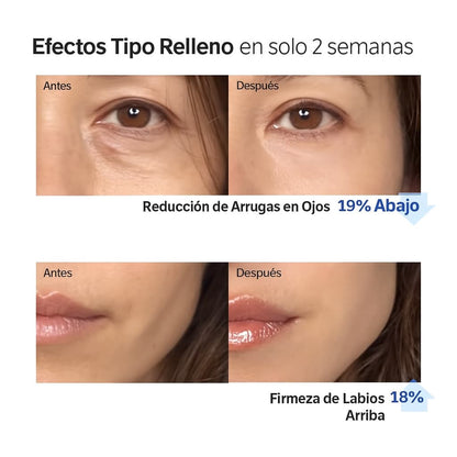 Sérum Voluminizador de Colágeno